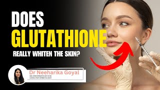 Does Glutathione really whiten the skin  Skin Whitening treatment in Hindi  Dr Neeharika Goyal [upl. by Nicolea]