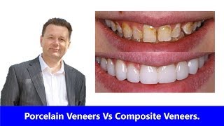 Porcelain Veneers Vs Composite Veneers Which is Best [upl. by Ikir]