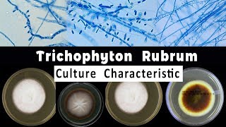 Trichophyton Rubrum culture Characteristic [upl. by Wawro]