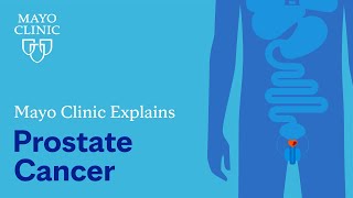 Mayo Clinic Explains Prostate Cancer [upl. by Dyane916]