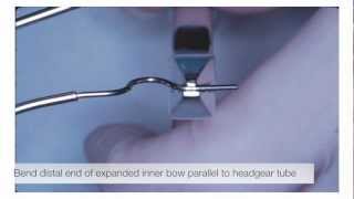 American Orthodontics  Facebow Bending [upl. by Sperling]