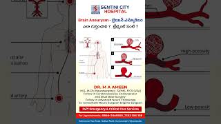 Brain Aneurysm  Symptoms amp Treatment  Sentini City Hospital shorts sentinicityhospital [upl. by Trini113]