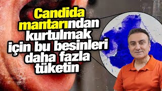 Candida mantarı ile savaşan besinler Candida diyeti [upl. by Lletnuahs254]