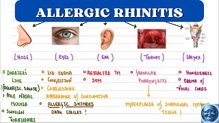 ENT🔥 II ALLERGIC RHINITIS II SIGNS AND SYMPTOMS II ARIA CLASSIFICATION II [upl. by Assilrac114]