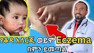 የቆዳ አለርጂ ወይም Eczema በምን ይመጣል  What causes skin allergy or eczema  Dr Fasil [upl. by Ydnim]