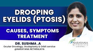 Drooping Eyelids Ptosis Know its Causes Symptoms and Treatment Kannada [upl. by Genovera375]