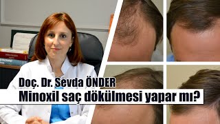 Minoxil saç çıkarma özelliği ile ne kadar etkilidir  Minoxil saçları döker mi [upl. by Croteau124]