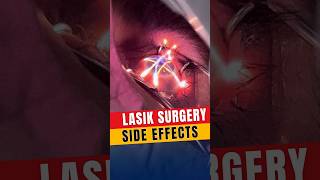 Side Effects Of Lasik Surgery [upl. by Campagna]