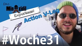 VLog Action Skispringen und Fotoshooting  Das Minoxidil Experiment Woche31 [upl. by Nirehtac897]