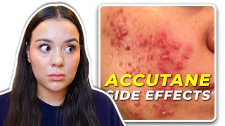 My 12 MONTHS Accutane SIDE EFFECT Timeline [upl. by Natala245]