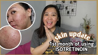 SKIN UPDATE ♡ 1ST MONTH OF MY ISOTRETINOIN JOURNEY [upl. by Lorilee]