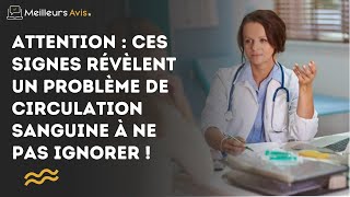 Attention  ces signes révèlent un problème de circulation sanguine à ne pas ignorer [upl. by Lathan]