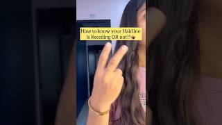 How to know your Hairline is receding OR not haircare tipsandtricks recedinghairlineproblme [upl. by Ynalem]