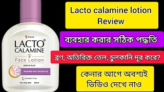 Lacto calamine face lotion reviewLacto calamine face lotion review in Bengali [upl. by Settera]