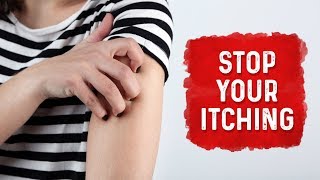 What Causes Hives and Itchiness  Urticaria Hives Treatment  Dr Berg [upl. by Ellirpa]