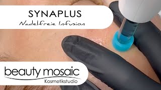 SYNAPLUS  Nadelfreie Infusion bei Beauty Mosaic [upl. by Hameean]