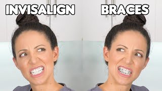 Braces or Invisalign Which is BETTER [upl. by Aisanat]