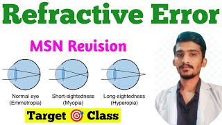 Refractive Errors  Hypermetropia  Myopia  Astigmatism  MSN Important Topic Eye MSN [upl. by Ahsiet]