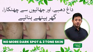 No more Dark Spots amp Two Tone Skin  Pigmentation treatment at home  Dark Spots on Face Removal [upl. by Aitercul346]