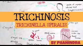 TRICHINOSIS  TRICHINELLA SPIRALIS  STRUCTURE  LIFE CYCLE  SYMPTOMS  BY PHANINDRA GUPTA [upl. by Aibar]