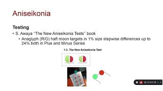 Anisometropia and aniseikonia testing [upl. by Kcirred]