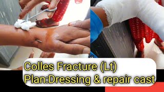 Colles Fracture LtPlanDressing amp repair castOur Treatment [upl. by Gibbs]