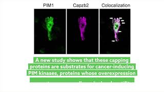 PIM1 accelerates prostate cancer cell motility by phosphorylating actin capping proteins [upl. by Pokorny744]