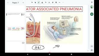 VAP  Ventilator Associated Pneumonia  VAP Bundle care  HAI  ICN [upl. by Jopa]