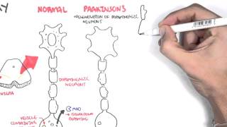 Pharmacology  Parkinsons Disease [upl. by Seuqramed]