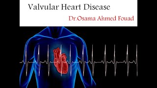 Valvular Heart Disease Part 1 [upl. by Aiyot]