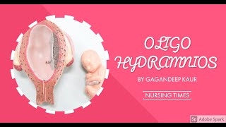 OLIGOHYDRAMNIOS Unit7 OBG HIGH RISK PREGNANCY [upl. by Mihar797]