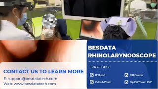 BESDATA RhinoLaryngoscope  Video Flexible Rhino Laryngoscope Clinical Use [upl. by Yelsehc979]