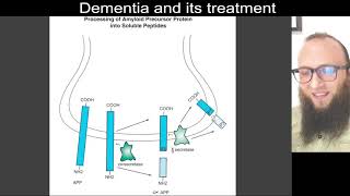 13 02  The amyloid cascade hypothesis of Alzheimer’s disease [upl. by Dielu]