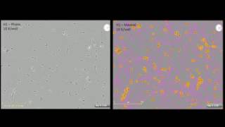 Study of Neurite Dynamics using NeuroTrack Assay [upl. by Connie732]