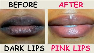 Dark Lips Treatment 100 Natural and Worked for Me  Dark Lips to Pink Lips Challenge [upl. by Castra]