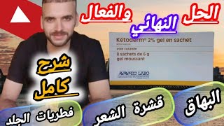 ketoderm 2  gel علاج فعال ومضمون للقضاء على القشرة والفطريات الجلدية والبهاق والأكزيماموانعهثمنه [upl. by Aracat]