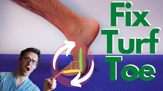 Turf Toe Injury BEST Treatment Causes Symptoms amp 3 Grades [upl. by Bullock]