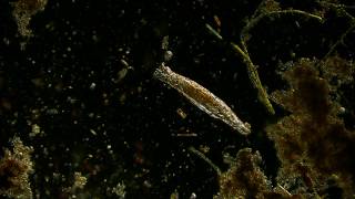 🔬 rotifer  offaxis illumination of microorganism in pond water under microscope 4K [upl. by Summer]