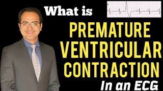 Premature Ventricular ContractionComplex PVC ECG Explained Treatment ECG Lectures USMLENCLEX [upl. by Holder]