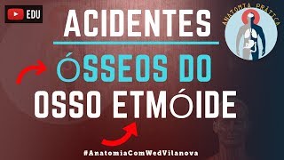 Osso Etmóide ACIDENTES ÓSSEOS Quais são❗❓DESCUBRA AQUI❗ Anatomia Prática [upl. by Yrahca34]