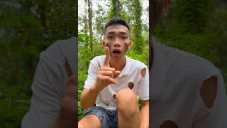 Snake Bite First Aid Quick Steps to Stay Safe ⛑️camping survival bushcraft outdoors lifehack [upl. by Ronny850]