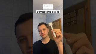 DermaStamp day 13 Dermaroller saç çıkartır mıDermaroller nasıl kullanılır saç hair dermaroller [upl. by Philpot545]