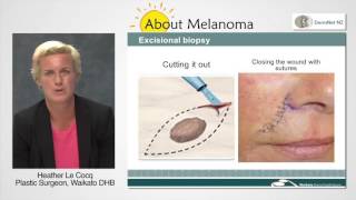 How Is Melanoma Removed [upl. by Refitsirhc]