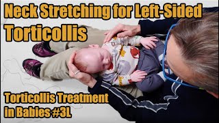 3L Neck Stretches for Leftsided Torticollis Torticollis Treatment in Babies [upl. by Pozzy]