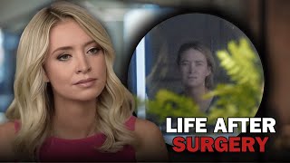 Kayleigh McEnany’s Transformation Is Turning Heads After Her Surgery [upl. by Dnalyr]