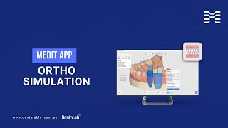 Medit App Ortho Simulation [upl. by Acinoreb963]