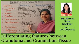 Granuloma vs Granulation tissue Differentiating features between Granuloma and Granulation tissue [upl. by Needan183]