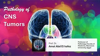 CNS Brain TumorsNeoplasms شرح محاضرة [upl. by Placido575]