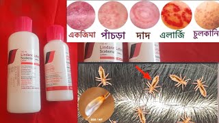 Lindane Lotion U S P  চুলকানি পাচডা ইতাদি বাংলা [upl. by Ambrogino]