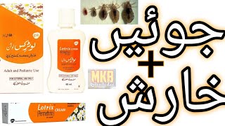 The SHOCKING Truth About Lotrix Lotion Urdu [upl. by Eelnodnarb]